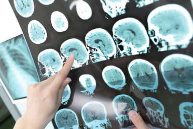 Neurobiologiste
